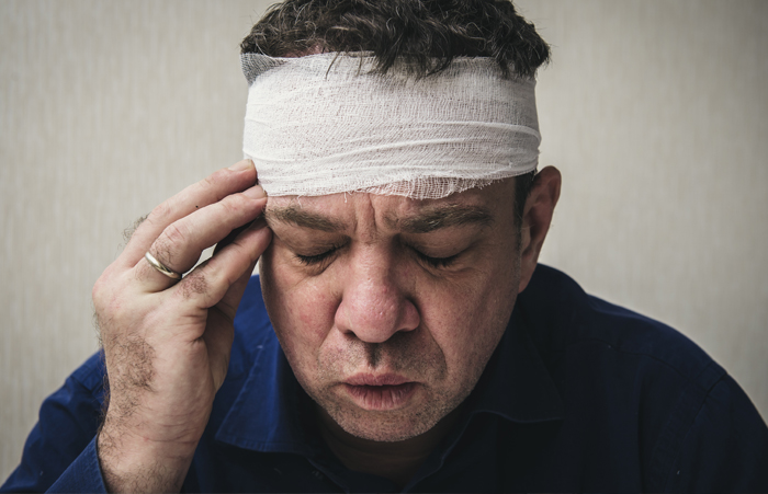 Myths About Traumatic Brain Injury 